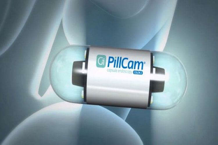 تماشا کنید: سفر PillCam، دوربین بلعیدنی در بدن