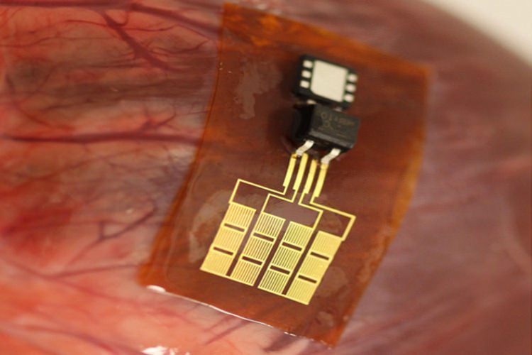 دستگاه کوچکی که می‌تواند تنظیم‌کننده‌ی ضربان قلب را از طریق ضربان قلب شارژ کند