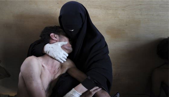 جایزه بهترین عکس سال: تصویر زن یمنی که یکی از اقوام زخمی خود را نگه داشته است