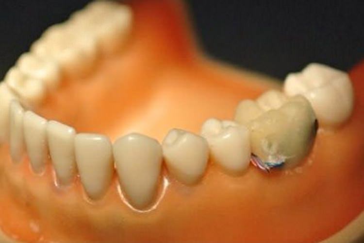 دندانهای الکترونیکی: گزارش مصرف دخانیات و نوشیدنی به پزشکان