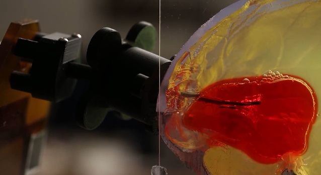 روبوتیک: کمک به پزشکان برای بیرون کشیدن لخته‌های خون از مغز