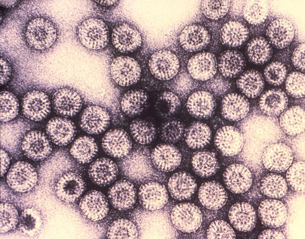 rotavirus-particles-141023